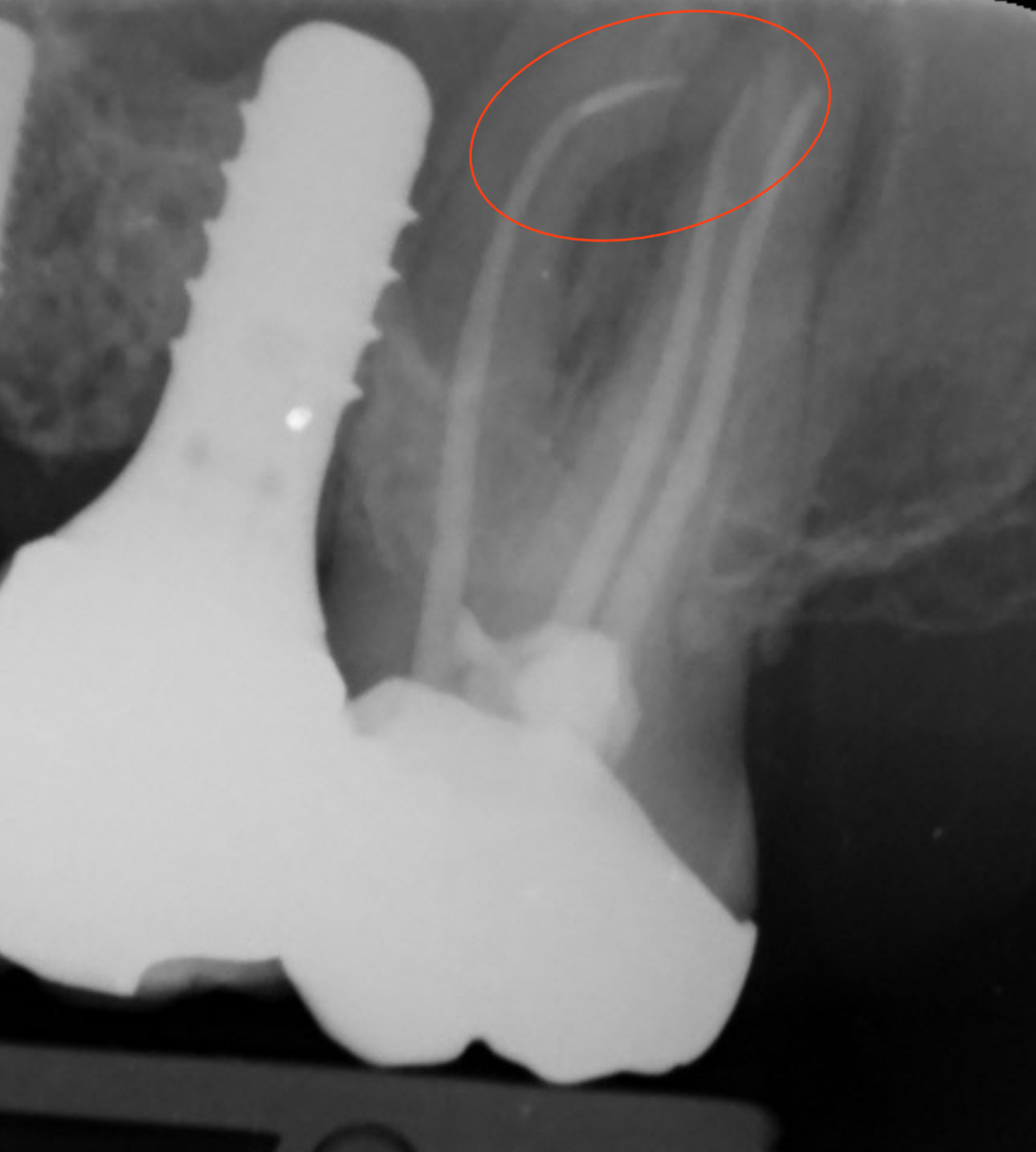 Removing broken files using Ultrasonics