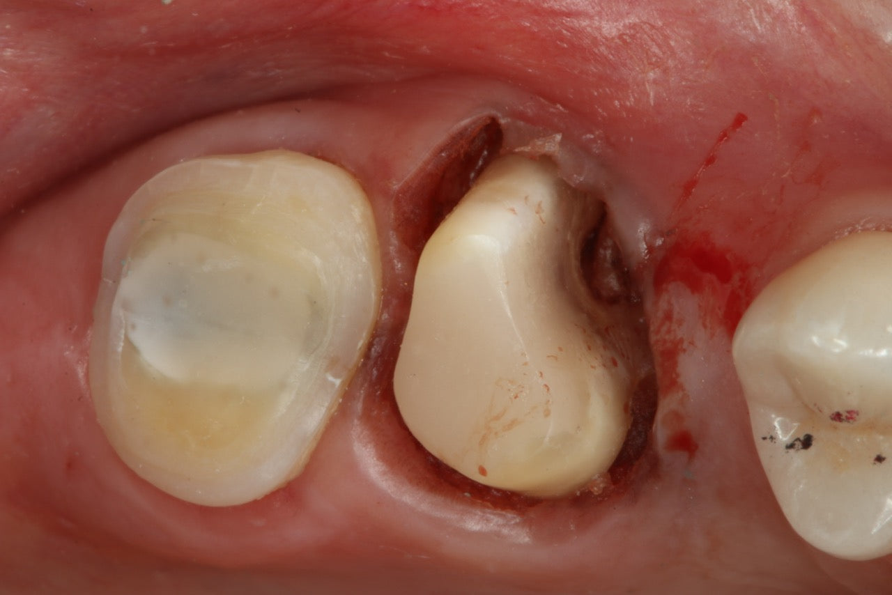 Composite and Core Materials