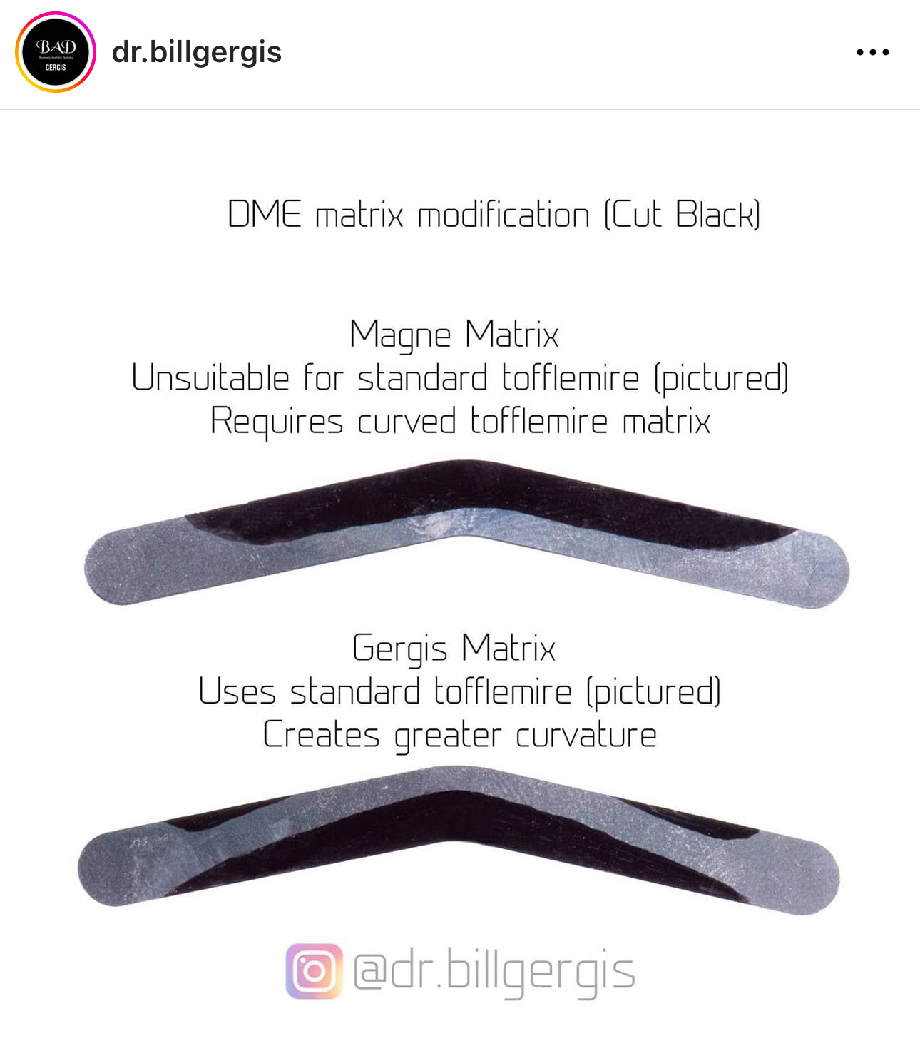 Tofflemire metal matrix bands