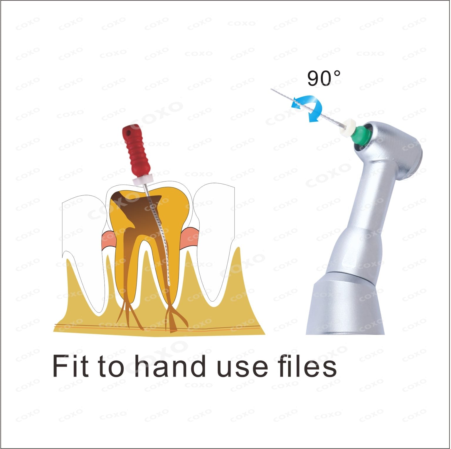 10:1 Hand file contra-angle handpiece with 90 degree reciprocation for negotiation of complex anatomy.