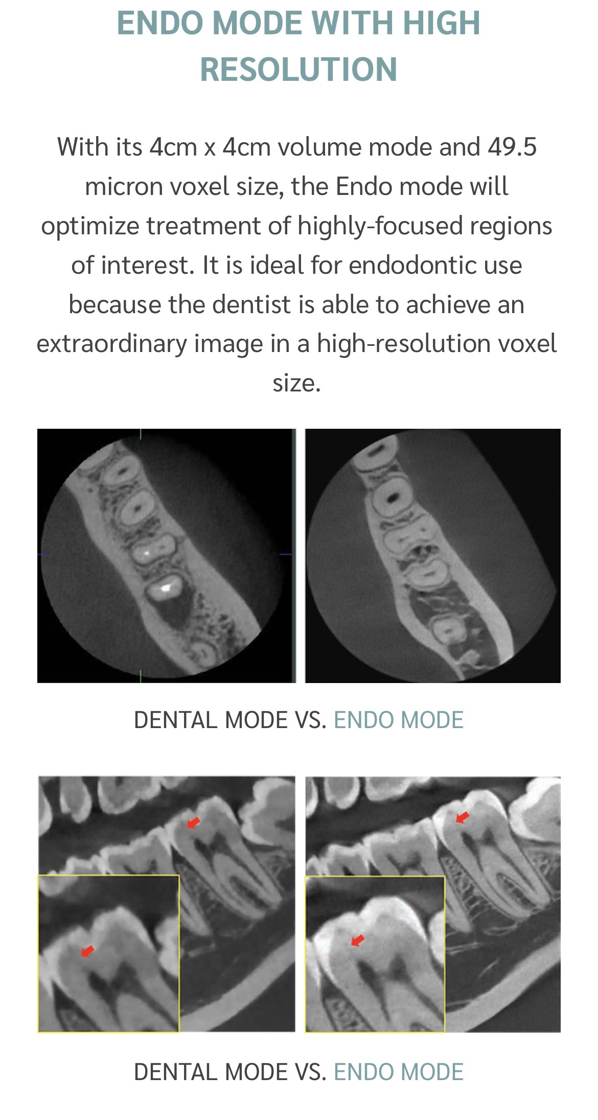 Vatech CBCT