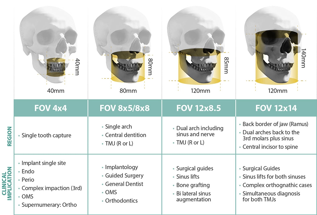 Vatech CBCT