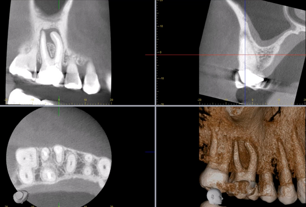 CBCT course level 1 & level 2 with emphasis on endodontics-6th & 7th September 2024